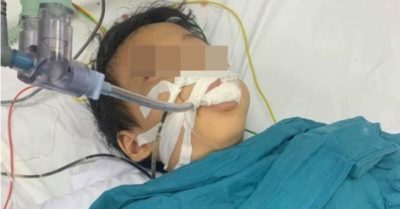 Học sinh lớp 1 đang lọc máu, chạy thận… vì ăn thuốc chuột hình viên kẹo