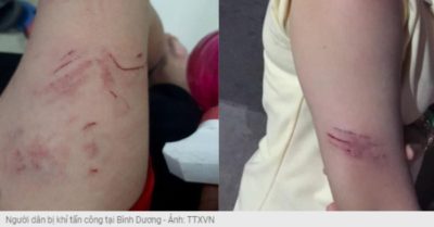 Đàn khỉ lạ cào, cắn 8 học sinh tiểu học ở Bình Dương