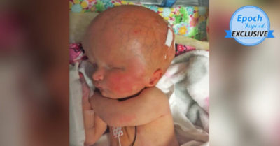 Bé gái sinh ra thiếu 2/3 não và không có nhãn cầu