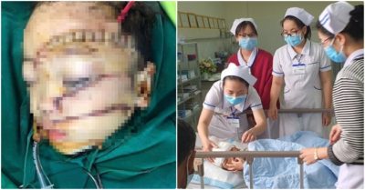 Bé trai 5 tuổi bị cha ruột chém, phải khâu hơn 300 mũi