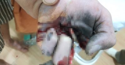 Nát tay vì vừa chơi game, vừa sạc điện thoại