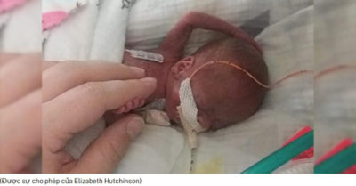 Một em bé kiên cường được sinh ở tuần 21 dù cơ hội sống sót là 0%