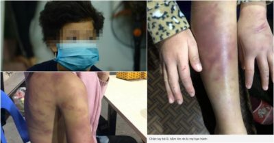 Bé 12 tuổi bị bạo hành, xâm hại: Cha mẹ còn nhưng con sẽ phải vào trại trẻ mồ côi?
