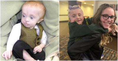 Mắc chứng dị tật bẩm sinh, cậu bé sống sót bất chấp tỷ lệ 1 trên 10000