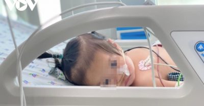 TPHCM: Cảnh báo bệnh tay chân miệng gia tăng ở mức báo động