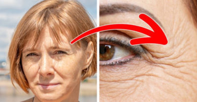 8 thói quen hàng ngày khiến chúng ta có nếp nhăn