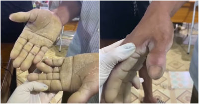 Đôi bàn tay của người cha nuôi con vào đại học