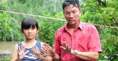 Miền Tây: Gia đình 3 thế hệ đều có 24 ngón tay, chân và nỗi lòng ‘gà trống nuôi con’