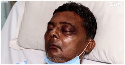 Tin tức tối 26/5: 115 ca nhiễm mới; Người dân Ấn Độ mắc thêm bệnh lạ: Bác sĩ nói ‘lần đầu tiên thấy ở người’