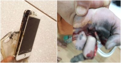 Vợ cụt 3 ngón tay, chồng bị thương do điện thoại phát nổ