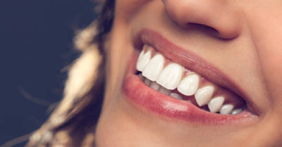 4 hỗn hợp tự nhiên giúp loại bỏ mảng bám khỏi răng