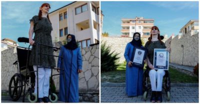 Người phụ nữ cao nhất thế giới do mắc bệnh lạ