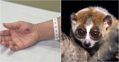 Người phụ nữ đầu tiên ở Hà Nội bị con cu li cắn, vài phút sau giọng nói yếu hẳn đi