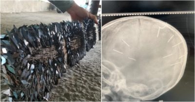 Tin tức tối 18/1: Thêm 16.838 ca Covid-19, số ca Omicron lên 70; Bé gái 3 tuổi bị 9 vật thể giống đinh găm trong sọ; Thu gom gần 1 kg mảnh đinh đoạn đường 50 m trên QL1