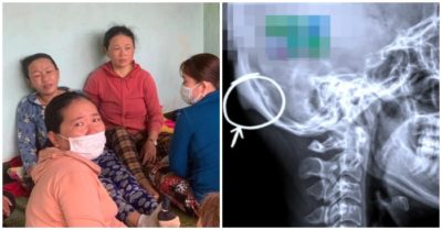 Tin tức sáng 16/2: Mẹ nam sinh mất tích: ‘Con chào đi nhập học, nào ngờ lại ra đi mãi mãi!’; Người phụ nữ ‘mọc đuôi’ ở sọ vì cầm điện thoại sai cách; Nam sinh lớp 6 tử vong khi xô xát với bạn