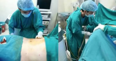 Vụ cô gái tử vong sau khi nâng mũi, hút mỡ bụng “chui” ở TP. HCM: Khởi tố 3 bị can