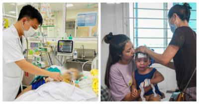 Tin tức sáng 21/7: Bộ Y tế: ‘Hoại tử xương mặt không phải bệnh lạ’; Hà Nội ghi nhận hơn 2.600 ca mắc cúm, nhiều ca nguy kịch