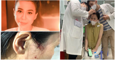 Hoa hậu Oanh Lê tố bị công an đánh