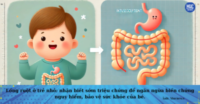 Lồng ruột ở trẻ: bé 8 tháng tuổi biến chứng nặng, lời cảnh báo