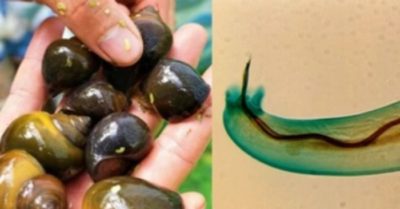 Ăn ốc tái, người phụ nữ bị giun phổi chuột xâm nhập vào não