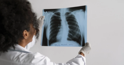 Ô nhiễm không khí: Thủ phạm âm thầm đẩy người Việt vào “bẫy” COPD