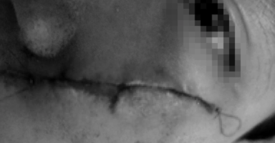 Bé trai co giật sau khi bị đánh bằng xẻng ở mái ấm Thiên Thần: Camera hỏng, ai chịu trách nhiệm?