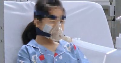 Kỳ tích: Cứu sống bé gái 14 tuổi mắc biến chứng hiếm gặp của lupus ban đỏ hệ thống