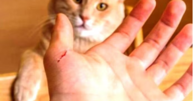 Bé trai lớp 6 ở Lào Cai tử vong nghi do mèo cào nhiễm virus dại: Cảnh báo khẩn về phòng bệnh.