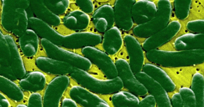 4 người Mỹ tử vong vì vi khuẩn ăn thịt người