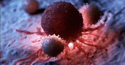 7 thói quen hàng ngày âm thầm làm tăng nguy cơ ung thư