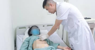 Trở về từ Nga, người phụ nữ phẫu thuật lấy 14 viên sỏi túi mật tại Việt Nam