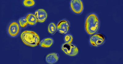 Nấm kháng thuốc – ‘bóng ma’ mới của y tế toàn cầu