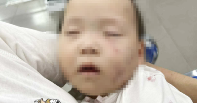 Bắc Ninh: Tạm giữ cô giáo mầm non vì hành vi gây thương tích cho trẻ nhỏ