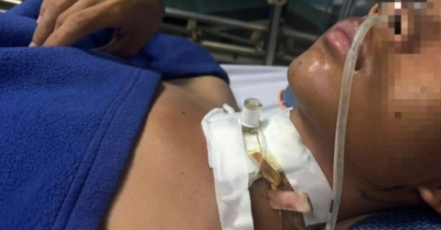 Nam thanh niên đứt khí quản vì vướng dây điện giữa đường