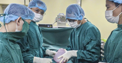 Bụng phình to bất thường, cô gái 19 tuổi bàng hoàng khi phát hiện khối u buồng trứng khổng lồ