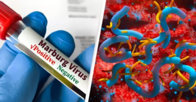 WHO báo động kép: Dịch bệnh “chảy máu mắt” và dịch tả toàn cầu