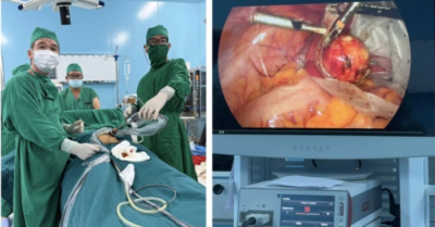 Ê-kíp bác sĩ TPHCM phẫu thuật thành công bướu quái buồng trứng cho bệnh nhân tại Côn Đảo
