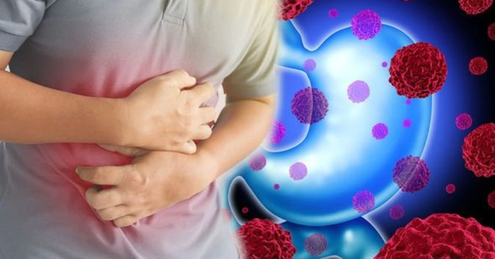 Phát hiện sớm ung thư giúp tăng cơ hội sống sót cho nam giới
