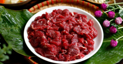 Sỏi thận và những thực phẩm bất ngờ ‘nuôi’ sỏi trong cơ thể