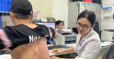 Bệnh vảy nến: Cần mở rộng hỗ trợ điều trị tại địa phương
