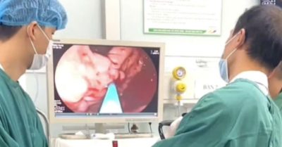 Xuất huyết tiêu hóa – Biểu hiện và cách phục hồi