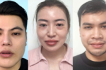 Nhiều “bác sĩ giả” chữa bệnh cho hàng trăm người ở phòng chăm sóc da