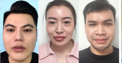 Nhiều “bác sĩ giả” chữa bệnh cho hàng trăm người ở phòng chăm sóc da