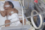 Bé gái 5 ngày tuổi bị thủng dạ dày do mẹ cho ăn cơm ngay sau sinh