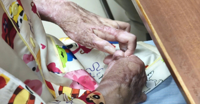 Nữ sinh bị bỏng nặng khi đốt keo nến lúc tập văn nghệ