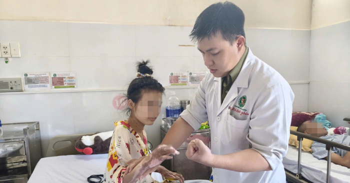 Nữ sinh bị bỏng nặng khi đốt keo nến lúc tập văn nghệ