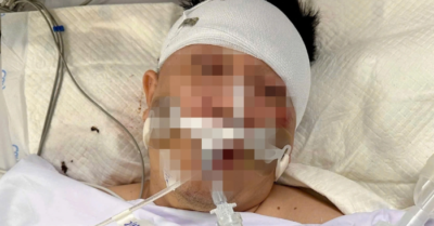 Nam thanh niên nguy kịch vì tông trúng chó chạy rông ở cầu vượt Gò Dưa