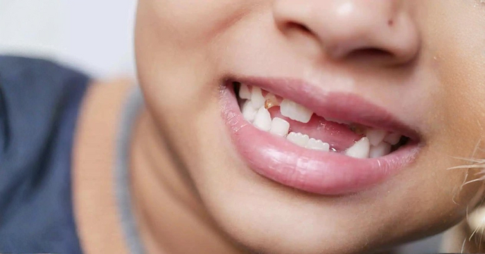 vì sao con người có răng vĩnh viễn