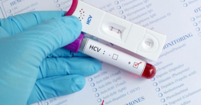 Những nhóm người cần khám gan sớm để ngăn ngừa biến chứng nguy hiểm