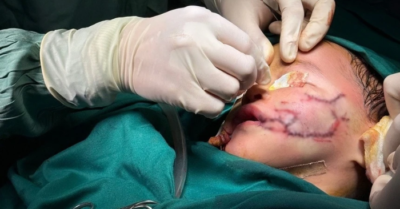 Virus dại tấn công hệ thần kinh, mất mạng chỉ trong vài ngày